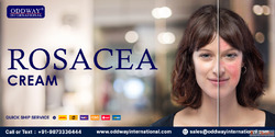 Best Rosacea Cream for Sensitive Skin - Oddway International