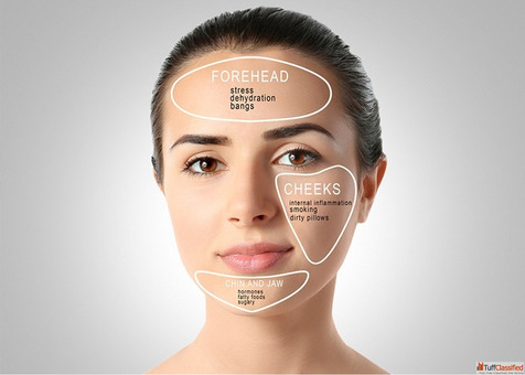 Acne Treatment - Clear Skin Renewed Confidence