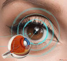 Trusted Cornea Surgeon in Ghodbunder - Specialized Eye Care ...