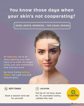 Dark Spot Remover for Face Jubilee Hills Hyderabad