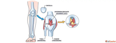 ACL Knee Ligament Surgery in Ahmedabad Expert Care