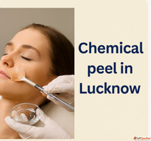 Chemical Peel Treatment in Lucknow