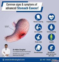 Leading Stomach Cancer Specialist In Ahmedabad Dr. Nitin Sin...