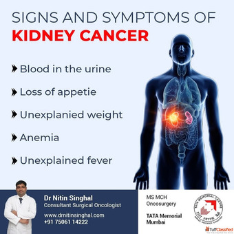 Kidney Cancer Surgeon in Ahmedabad Dr. Nitin Singhal
