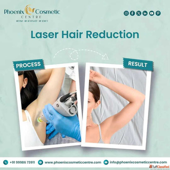 Best Laser Hair Reduction in Ahmedabad at Phoenix Cosmetic