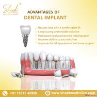 Best Dental Clinic in Coimbatore