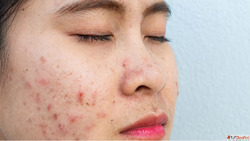 Natural Skin Care with Homeopathy Doctor in Gaur City