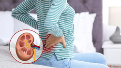 Kidney Stone Care by Experienced Homeopathy Doctor in Gaur C...