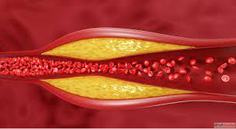 Lower Cholesterol Naturally with Homeopathic Medicine