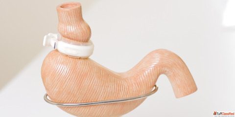 Looking for a Bariatric Surgery in Ahmedabad