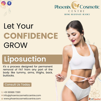 Phoenix Cosmetic - Affordable Liposuction Surgery in Ahmedabad