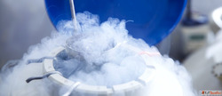 Best Semen Freezing Services in Bangalore