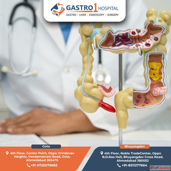 Expert Appendix Doctor in Ahmedabad - Gastro1 Hospital