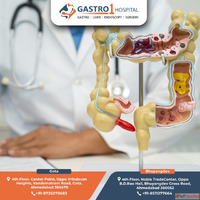 Expert Appendix Doctor in Ahmedabad - Gastro1 Hospital