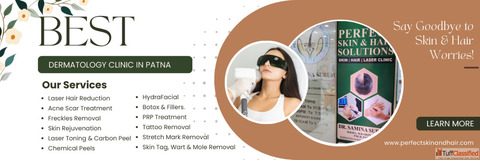 Advanced Mole Removal in Patna - Perfect Skin Hair Solutions