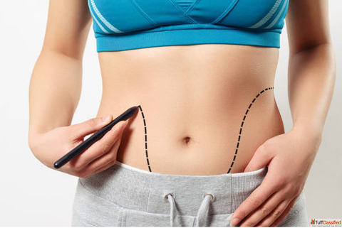 Liposuction in Riyadh