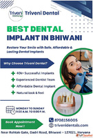 Best Dental Implant in Bhiwani Triveni Dental