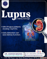 Systemic Lupus Erythematosus Treatment In Indore Dr. Ashish ...