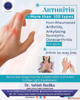 Heumatoid Arthritis Center In Indore Dr. Ashish Badika