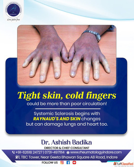 Systemic Sclerosis Care In Indore Dr. Ashish Badika