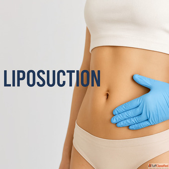 Fit Like Never Before Body Contouring liposuction in Gurgaon
