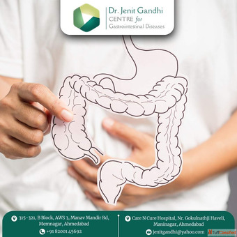Best Colon Cancer Treatment in Ahmedabad India - Nationwide Patient Support