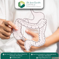 Best Colon Cancer Treatment in Ahmedabad India - Nationwide ...