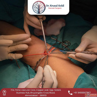 Expert Vascular Care by AV Fistula Surgeon in Ahmedabad Indi...