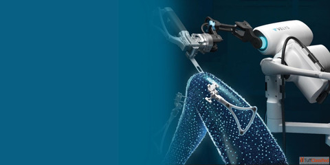 Advanced Robotic Knee Replacement Surgery in Ahmedabad - Precision Faster Healing