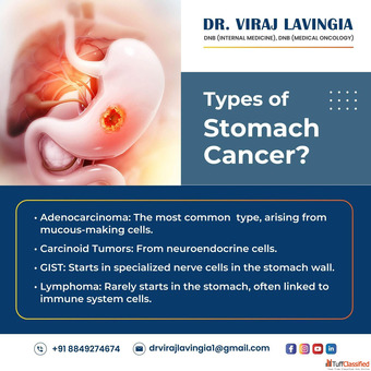 Effective Stomach Cancer Treatment in Ahmedabad Using Modern Technology