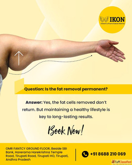 Liposuction Treatment In Tirupati