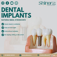Shinora Clinic - Dental Implant in Ahmedabad