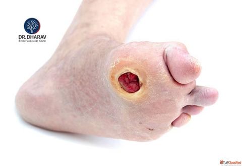 Dr. Dharav Kheradia Expert Diabetic Foot Surgeon Offering Advanced Care in MumbaiIndia