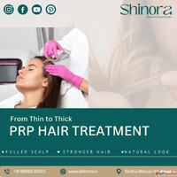 PRP for Hair Restoration in Ahmedabad at Shinora Clinic