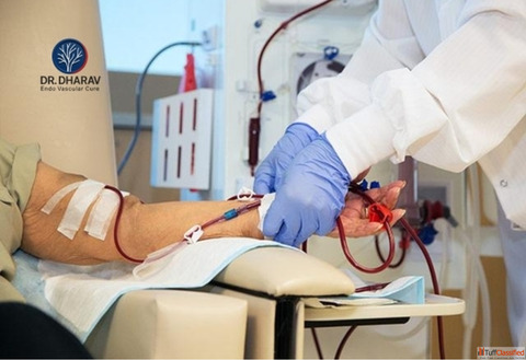Advanced AV Fistula Treatment in Mumbai by Dr. Dharav Kheradia
