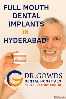 Full Mouth Dental Implant In Hyderabad Dr Gowd Dental Hospitals