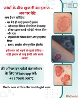 Jangho ke Beech Fungal Infection aur Khujli ka Ilaaj - Ghar ...