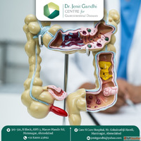 Dr. Jenit Gandhi - Specialist Appendix Surgeon in Ahmedabad ...