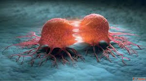 Lung Cancer Treatment in Delhi NCR