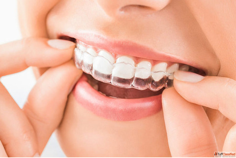 Teeth Whitening In Gurgaon