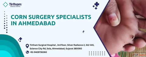Relieve Foot Pain Top Corn Surgeons in Ahmedabad