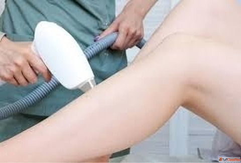 Advanced Laser Hair Removal Treatments in Gurgaon