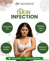 From Dull to Radiant The Power of Professional Skin Treatmen...