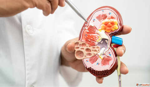 Trusted Homeopathic Doctor for Kidney Stone in Noida