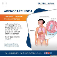 Advanced Stomach Cancer Treatment in Ahmedabad for All Stage...
