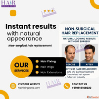 Non-surgical pain-free Hair Replacement