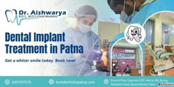 Dental Implant Treatment in Patna - Restore Your Smile with ...