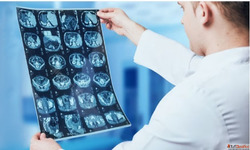 Best Radiology Hospital in India