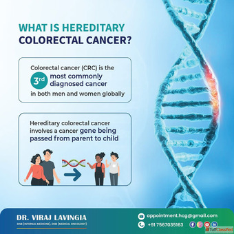 Effective Colorectal Cancer Treatment in Ahmedabad - Dr. Viraj Lavingia