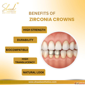 Good Dental Clinic in Coimbatore